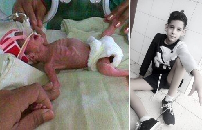 Lázaro Bartolo Santos, el niño que nació prematuro extremo en Ciego de Ávila, cumple 12 años de edad.
