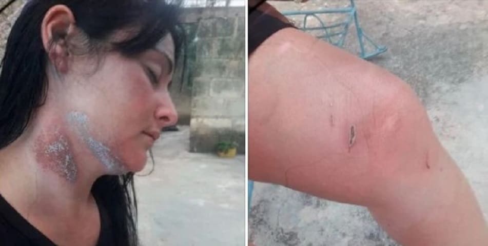 Conmovedor testimonio; joven cubana sobreviviente del naufragio de Cárdenas asegura no pueden precisar cuántas personas eran