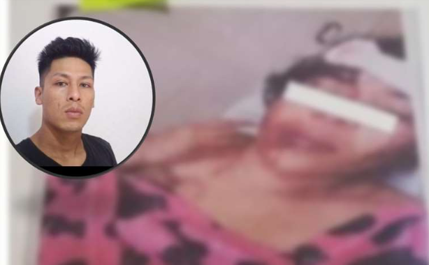 Madre cubana atacada con 6 martillazo por su ex-pareja en Bolivia